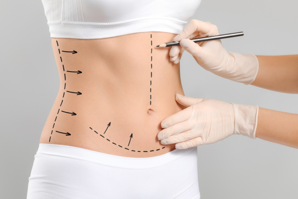 Tummy Tuck in Islamabad: Complete Guide to Abdominal Contouring